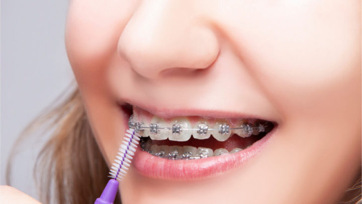 Top 4 Innovative Orthodontics Technology For The Past Decade